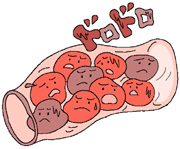 甘い物の食べ過ぎが、 冷え性の原因に？