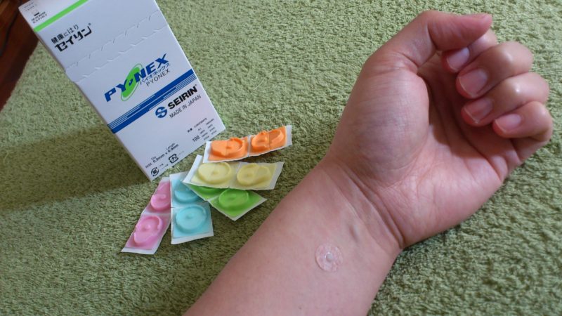 内関とパイオネックス